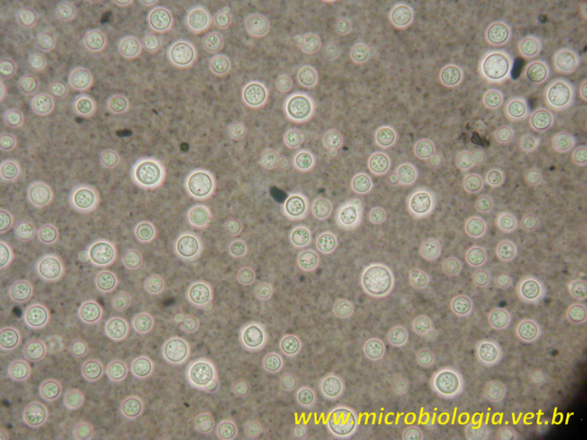 Cryptococcus_neoformans_2