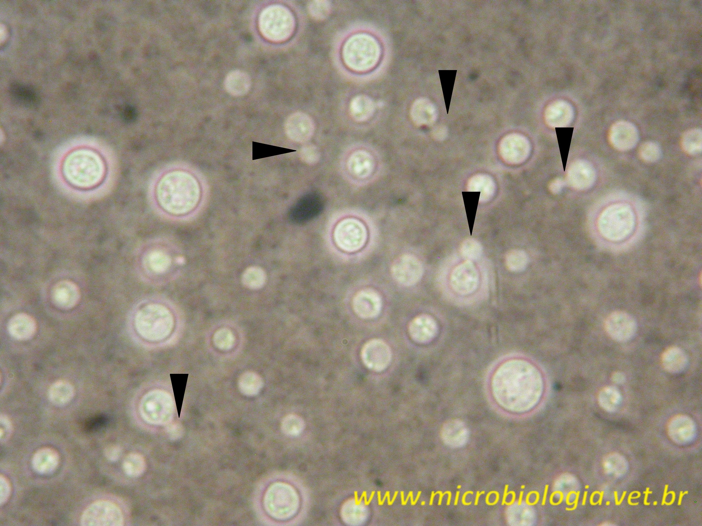 Cryptococcus_neoformans_3