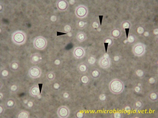 cryptococcus_3